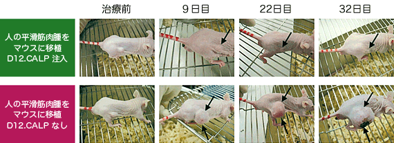 人の平滑筋肉腫を使ったマウス実験